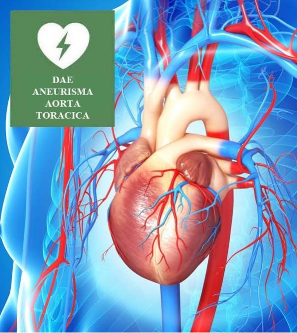 ANEURISMA DELL'AORTA TORACICA